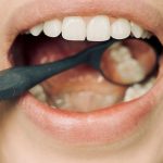 Dental Decay: Understanding Causes, Prevention, and Treatment